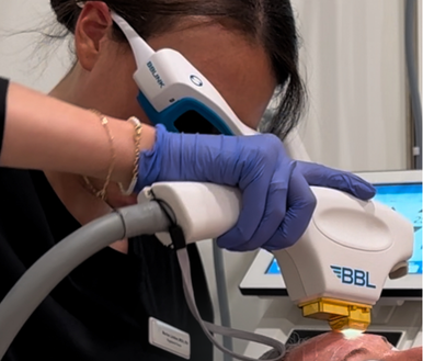Laser Treatments
